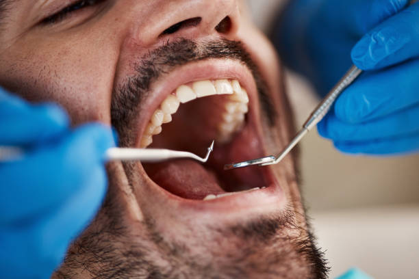 Best Urgent Tooth Repair  in Downs, IL